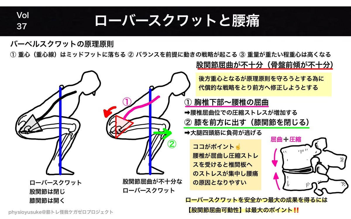 ユウスケ 筋トレ怪我ケガゼロプロジェクト On Twitter 11 26 最新版 スクワットで腰を痛めた人向け ローバースクワット と腰痛 股関節屈曲制限の腰椎への影響 バーベルsqの原理原則を理解する 股関節屈曲 の代償運動を理解する 腰椎の
