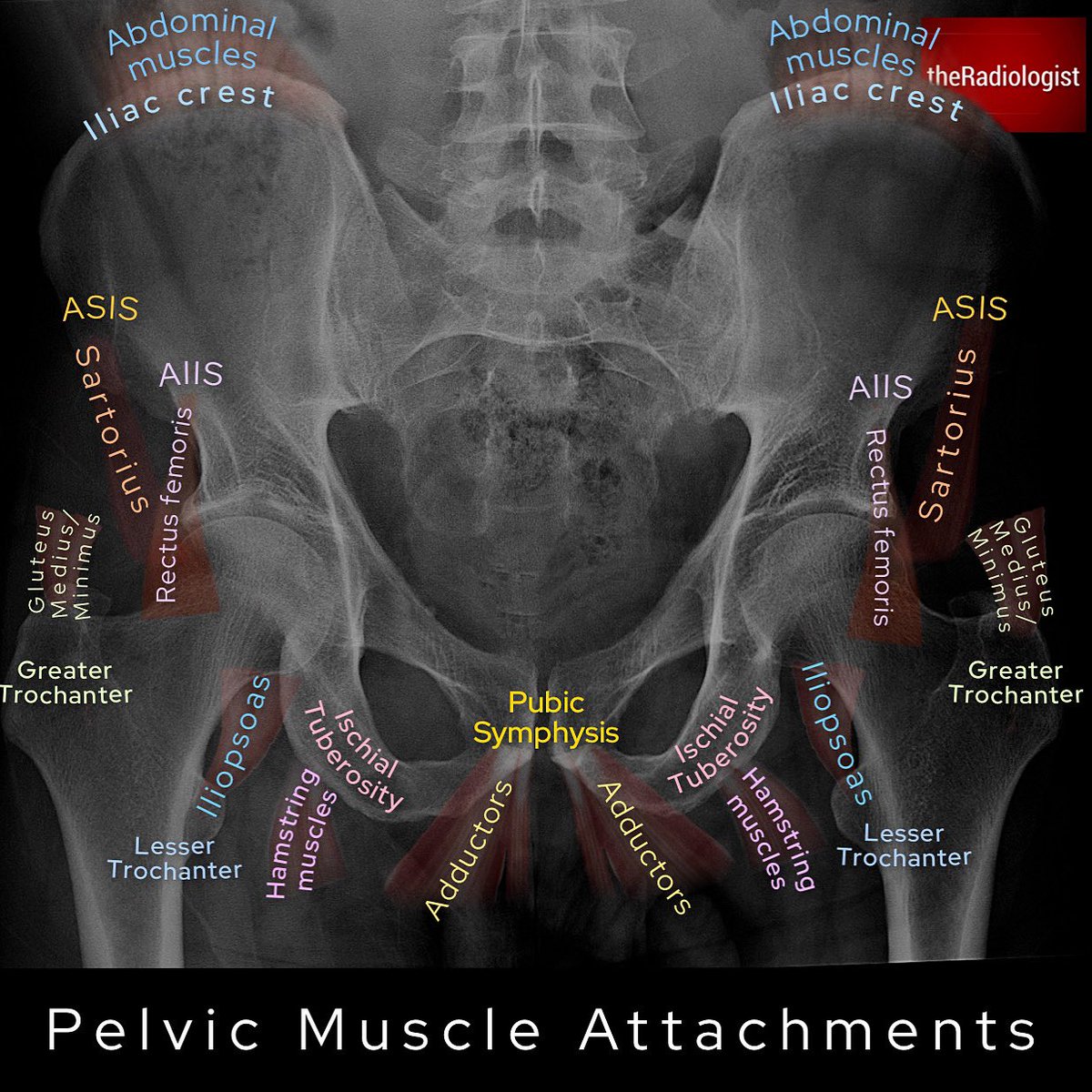 radiologistpage's tweet image. DIAGRAM: Pelvic muscle attachments 

#foamrad #foamed