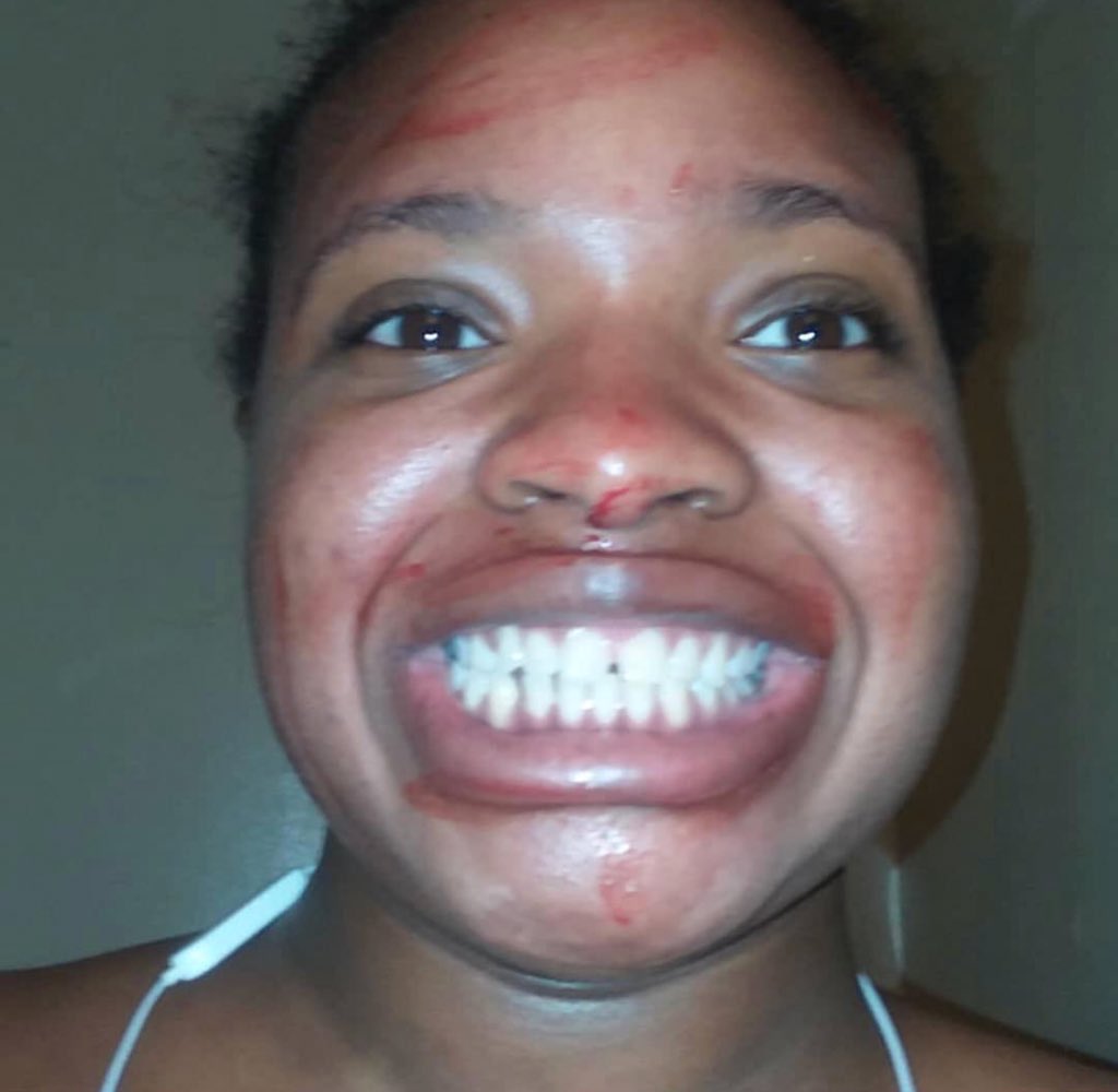 peachyperfect5's tweet photo. I like to get aye on my period, bitches be like is you seriousππ
#menstral
#yummy
#iphonegang
#peaches
#peachyperfect
#peachybaby
#lovelypeaches
#lovelypeachesmusic100
#queen
#eatmyassbitch
#cora
#coramiracle https://t.co/0x9MZj0bOW