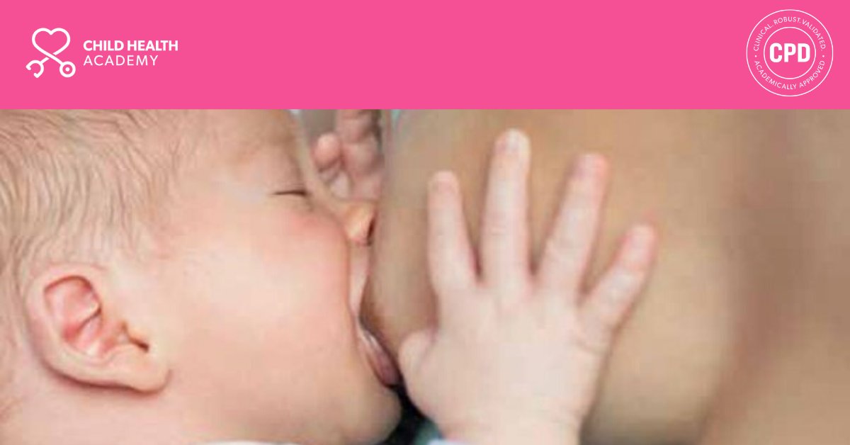 HealthProfAcad's tweet photo. The UK-wide Infant Feeding Survey reported that by 6 weeks after birth, only 23% of mothers were exclusively breastfeeding, and by 6 months this number dropped further to only 1%. Learn how you can better support parents through breastfeeding challenges: https://t.co/meGzSxIzcW https://t.co/kXzbZDdFqH
