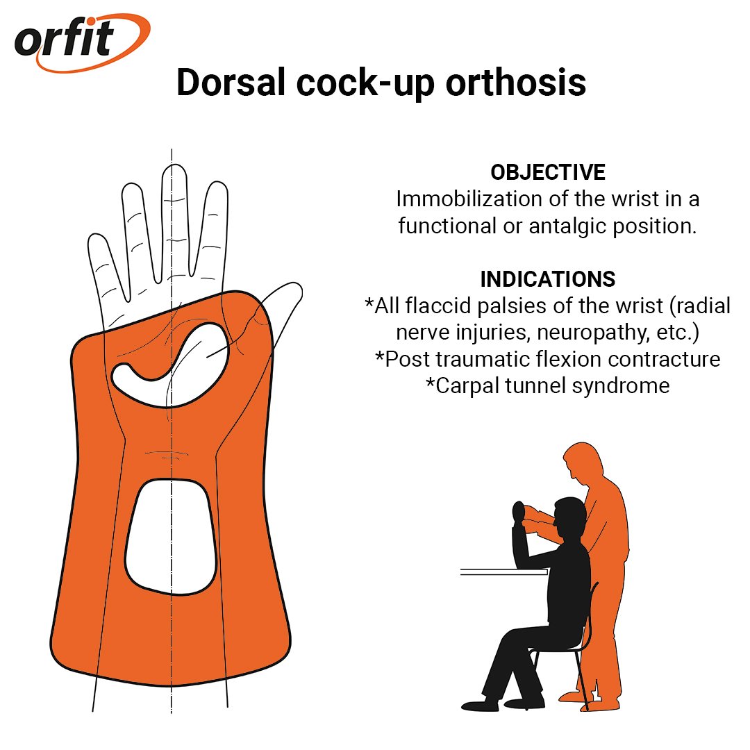 Orfit's tweet photo. Try the Dorsal Wrist Cock-Up Orthosis, a great design for various indications, including flaccid palsy and carpal tunnel syndrome.
Discover this tutorial and many more in the complete Splinting Guide >> https://t.co/fkd22QQAW3
#splintingguide #orthoticfabrication #orfit https://t.co/8N8uyZqDjG