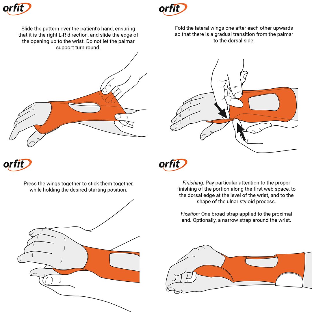 Orfit's tweet photo. Try the Dorsal Wrist Cock-Up Orthosis, a great design for various indications, including flaccid palsy and carpal tunnel syndrome.
Discover this tutorial and many more in the complete Splinting Guide >> https://t.co/fkd22QQAW3
#splintingguide #orthoticfabrication #orfit https://t.co/8N8uyZqDjG