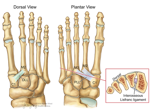 lisfranc ligament)