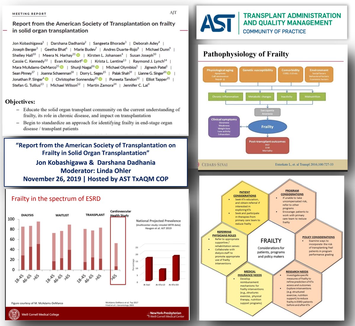 Thank You 🙏🏼 <a href="/AST_info/">American Society of Transplantation (AST)</a> #TxAQM #CommunityofPractice for excellent #JournalClub “#AST Consensus Report on #Frailty in #Transplantation.” While highly relevant to outcomes, more work is needed to #tailor monitoring &amp; mgmt to unique needs of frail #TransplantCandidates &amp; recipients