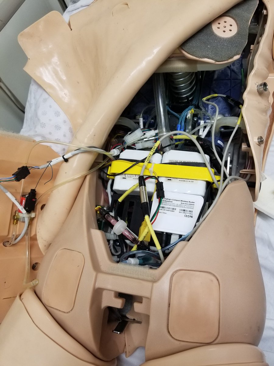 MSingh_MD's tweet image. Driving our monthly ED #InSituSimulation at @NYCHealthSystem #NorthCentralBronx #YoungFemale #Syncope #Hypotensive #WhatsTheBetaHCG #Shock #BelmontRapidInfuser @POCUS_Society #RUQFastView #HealthSIMNYC #SimulationSavesLives @laerdalmedical @BelmontInst