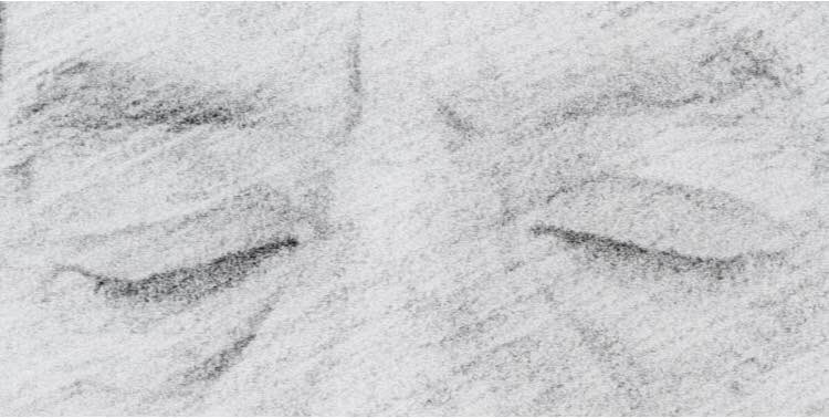 Hoy se confirmó que #GustavoGatica no volverá a ver nunca mas
Y la justicia? 
Y el gobierno? 
Y los pacos siguen disparando
Mañana chile despertará nuevamente pero uno no verá más el amanecer 🌅 
Maldito Gobierno!
#chilenoserinde #FuerzaGustavo #HastaQueLaDignidadSeHagaCostumbre