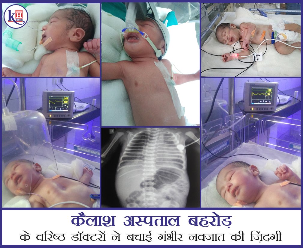 #Neonatal #BirthAsphyxia #ChildSpecialist #NewBorn #ChildCare #KailashHospitalBehror #Behror

कैलाश अस्पताल बहरोड़ के वरिष्ठ डॉक्टरों ने बचाई गंभीर नवजात की ज़िंदगी
आगे पढ़े: bit.ly/33pe0Im