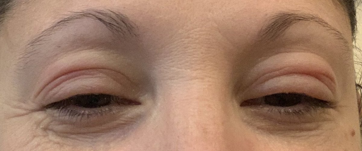 LoriLorusso's tweet image. Nice! Here’s ‘looking’ at you kid! #notaboxer #imsexyandiknowit #steroidsdontfailmenow