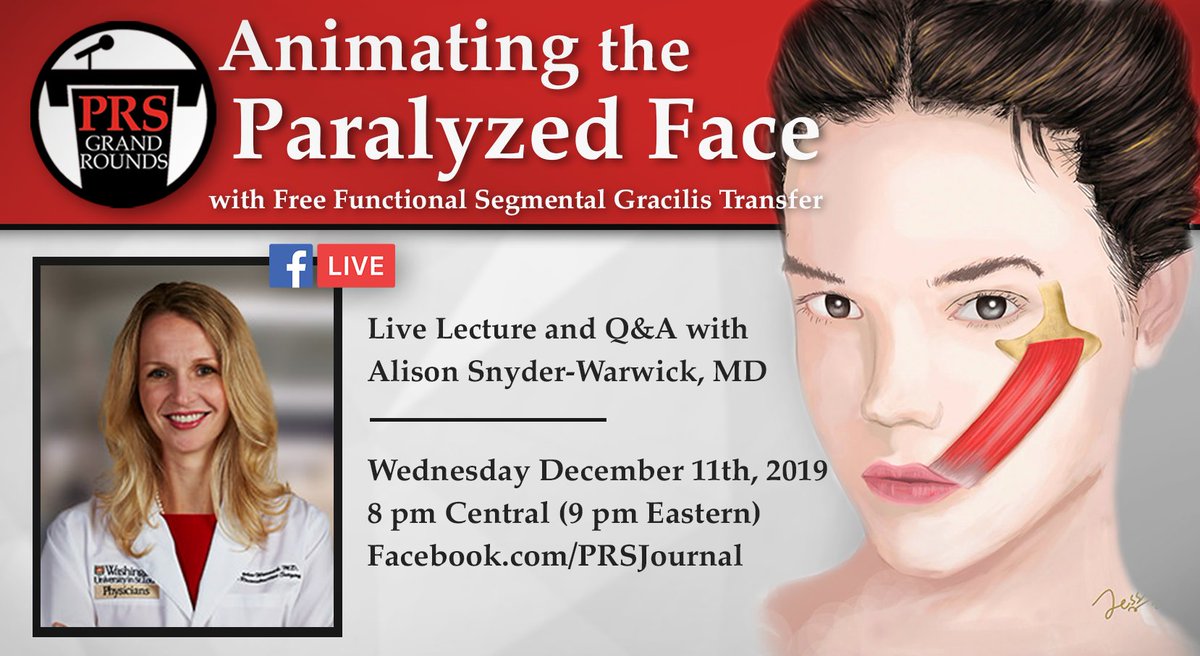 #PRSGrandRounds Facebook LIVE LECTURE/Q&amp;A is BACK! 
Dec 11 at 8 pm CT w/ Dr. Snyder-Warwick: “Animating the Paralyzed Face with Free Functional Segmental Gracilis Transfer," on the #PRSJournal Facebook page!

Read the collection for FREE: bit.ly/GRDec19_Collec…

#PlasticSurgery