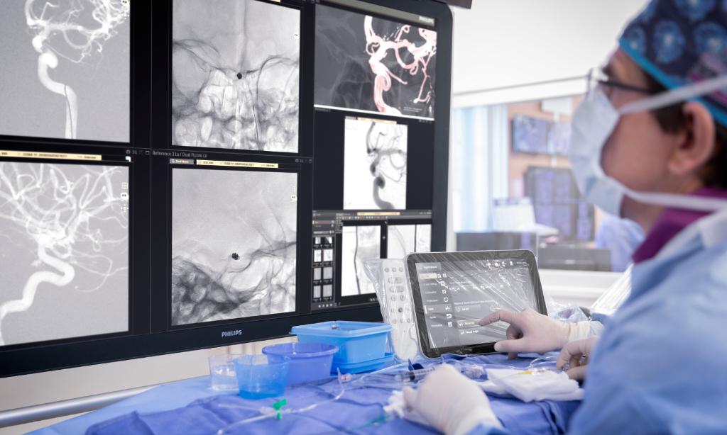 PhilipsPR's tweet photo. One millionth procedure carried out on @Philips Azurion advanced image-guided therapy platform https://t.co/EuIVSU6MG3 #imageguidedtherapy #IRad https://t.co/4xlGY71aHD