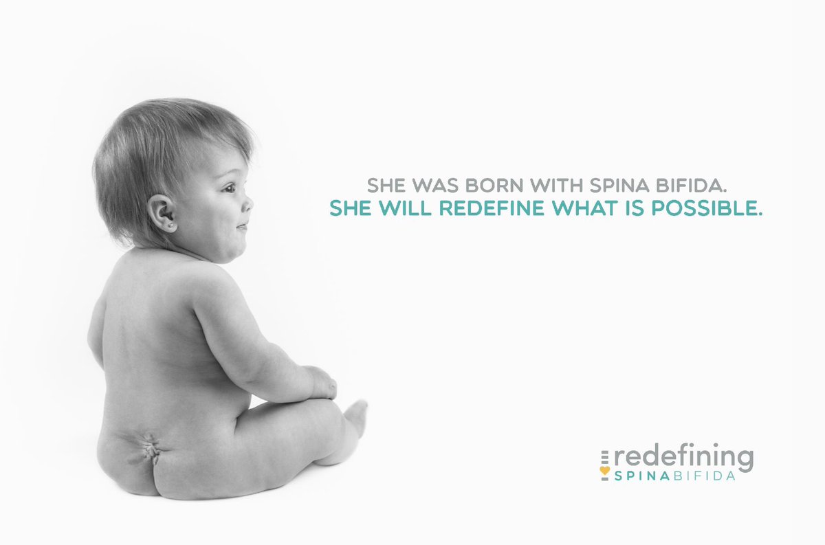 fightlikeava's tweet photo. #RedefiningSpinaBifida #SpinaBifida #FetalSurgery #TwiceBorn #Abled #BornDifferent #SpecialNeeds #Preemie @FOXANDFRIENDS4 @FoxnFriendsFix @abilitymag @TheEllenShow @ellentube @TheTodayShow @parentsmagazine https://t.co/J3EyLYw91l