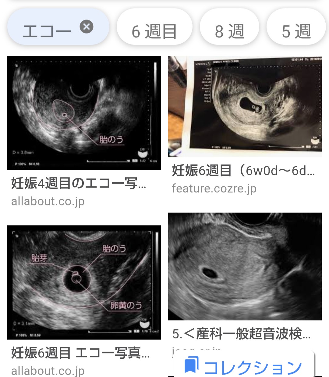 R On The Road 娘に子供が出来ました 自分にとっては初孫です 娘が結婚して 軽く一年以上は子供が出来なかったので そろそろとは思ってましたが娘のお腹の中で少しづつ成長しています 命の大切さ 神秘さを改めて感じます とにかく 元気な