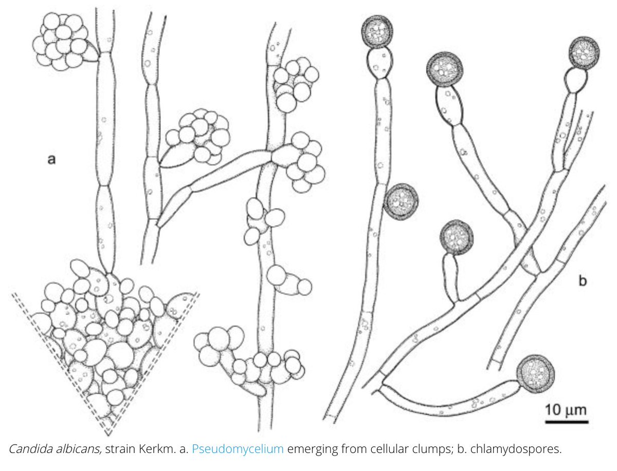 12/ #IDDailyPearl for some of the Candida-  #albicans- most common--can use fluc or echinocandin for bloodstream, may prefer one depending on clinical situation-  #glabrata- many are resistant to fluc--seen more in elderly & cancer/SOTimages from  http://www.clinicalfungi.org/ 