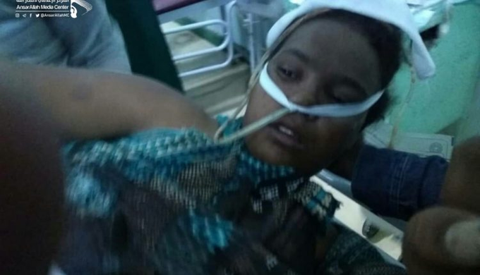 stopalsaud4's tweet photo. #Saudi-led coalition forces shelled a gathering of #Somali and #Ethiopian migrants in the border district of Monabeh in #Saada province, killing 10 and injuring 35 others.
https://t.co/Q1vUO7Orhp https://t.co/FqezkIlTgW
