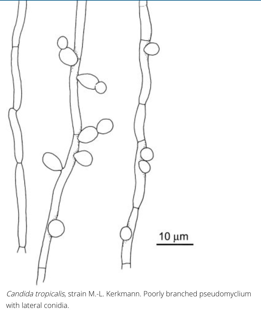 13/ #IDDailyPearl -  #parapsilosis- biofilm on central lines--can have higher MICs to echinocandins-  #tropicalis-freq in heme malig & stem cell tx-  #krusei-freq in immunodef & prolonged azole therapy --intrinsically resistant to flucimages from  http://www.clinicalfungi.org/ 