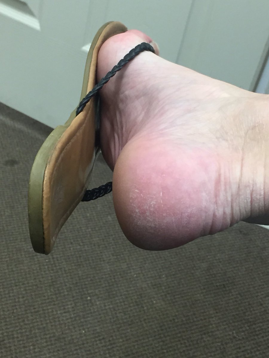 SteveTunes1's tweet photo. My feet in flip flops #myfeet #mensfeet #boysfeet #malefeetinflipflops https://t.co/xtOI3GFukq