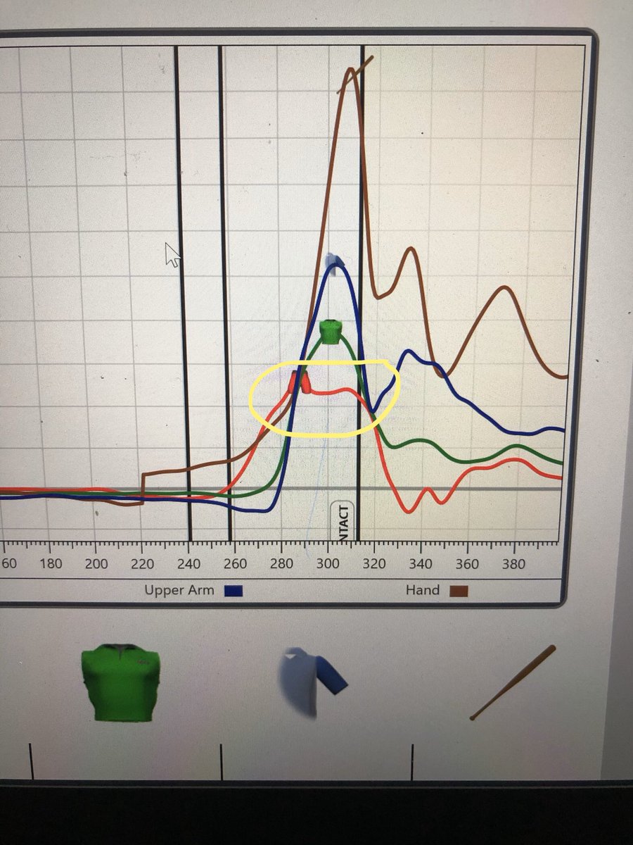 first time using the equipment. We noticed her time to contact was below average, 0.17-0.18 and her K-vest graph showed poor pelvis deceleration (notice the plateau of the red line, which represents her pelvis speeds). I went to her mobility assessment, no obvious issues. 2/