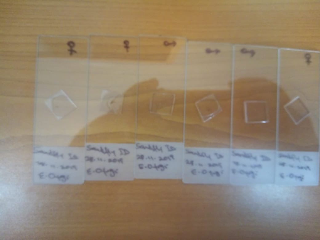 AlliKnowAreBugs's tweet photo. Mosquito and Sand Fly Identification Clinic. My team were awesome and it was fun for me to ID and see for the first time a few African species. #Motherland #Kenya #Entomologist #VectorDiseases #Skeeters #Flies #HappyPlace https://t.co/CDv7npIXli