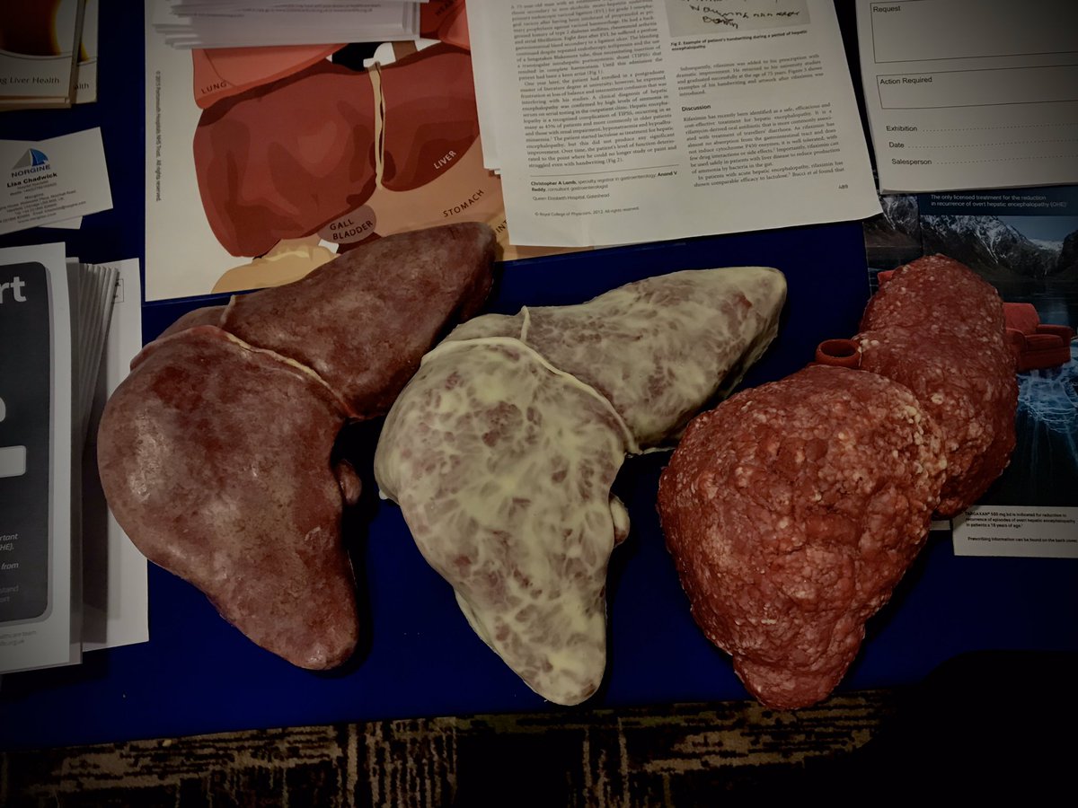 RiciaGwenter's tweet photo. Had a great day learning about all things liver! #medicineisbrilliant #liverstudyday @NWDoctors @BetsiCadwaladr https://t.co/wiGXFyTDPz