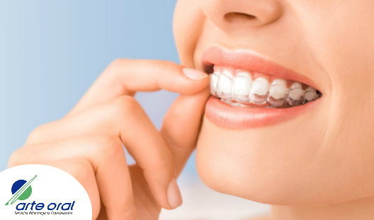 Arte_Oral's tweet photo. Después de terminar tu tratamiento de ortodoncia necesitarás retenedores para mantener tus dientes alineados. Conoce los tipos y las ventajas. Haz clic aquí: https://t.co/gxMrsdd0h7
#ClínicaDental

Puede interesarte: Alimentos que afectan tu salud dental: https://t.co/Xt7psqtXDE https://t.co/weEKTTcvOK