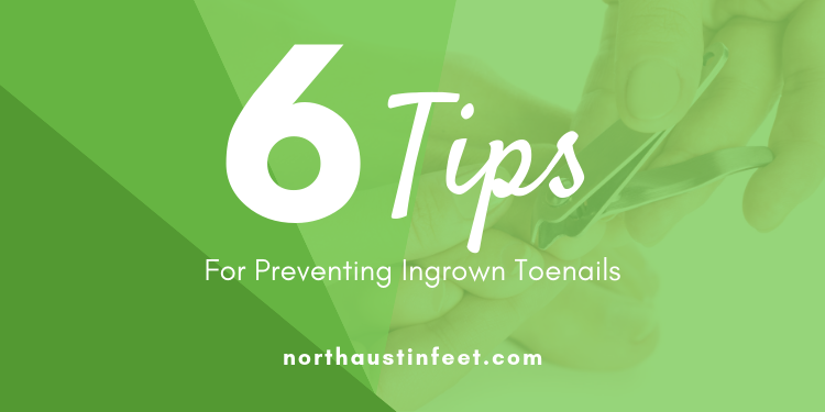 NorthAustinFeet's tweet photo. ingrown toenails hurt! Check out these 6 tips on what you can do to prevent them, here - https://t.co/58UNBwkfFN https://t.co/r19zz5CYHR