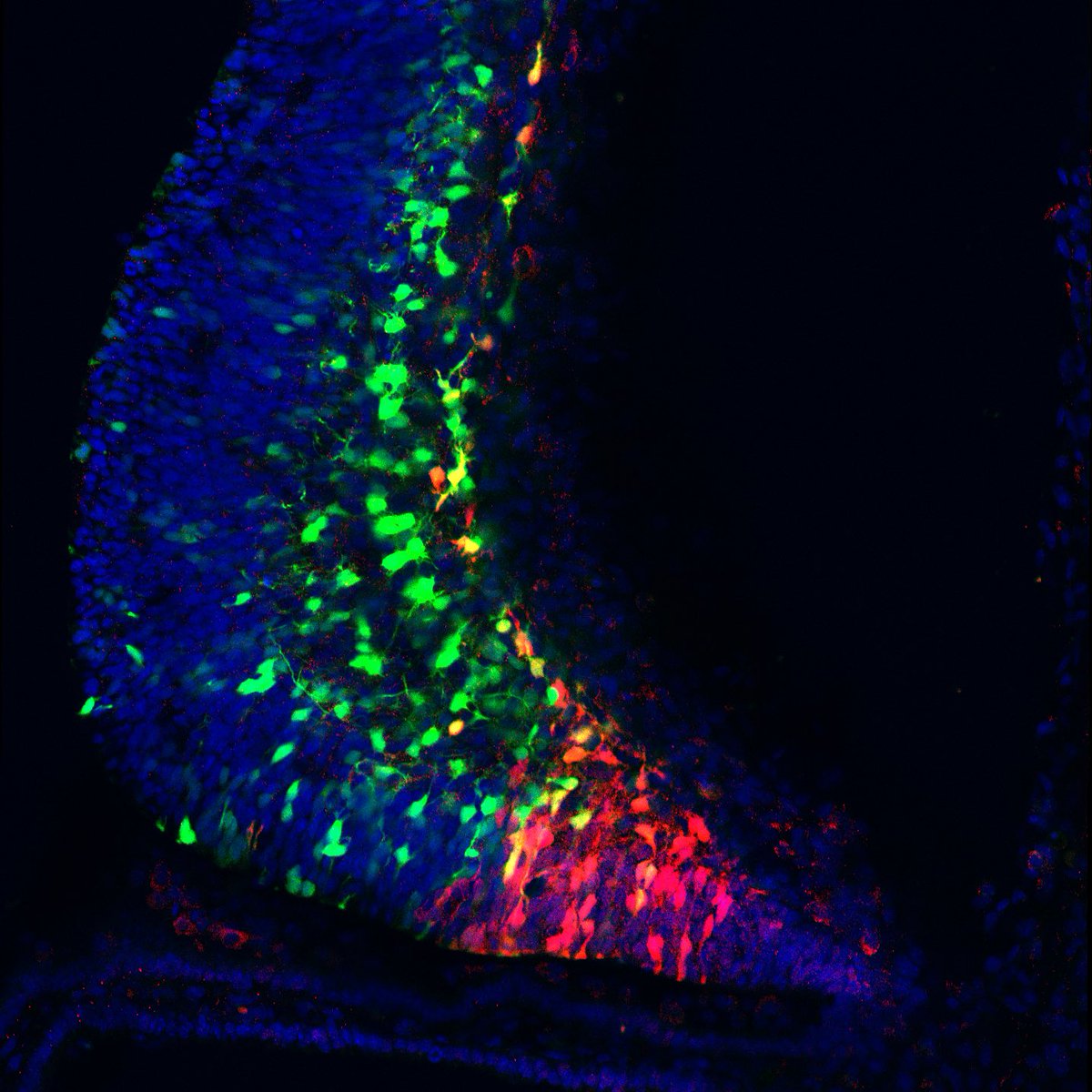 CSD_CUAMC's tweet photo. Another former @CSD_CUAMC student, Santiago Fregoso @SPFregoso, is now a postdoc in the Millen lab @neurodevKathy at Seattle Children’s. In @TheFrancoLab, Santiago was studying the gene regulatory logic of neural progenitor subtypes in the forebrain. #CSDtakeover https://t.co/HqR78VIhD5
