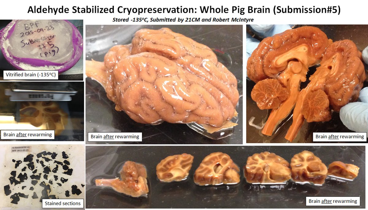 47) In 2018, the nonprofit Brain Preservation Foundation (BPF) announced that cryobiology research company 21st Century Medicine had won the Large Mammal Brain Preservation Prize. https://gizmodo.com/new-brain-preservation-technique-could-be-a-path-to-min-1823741147