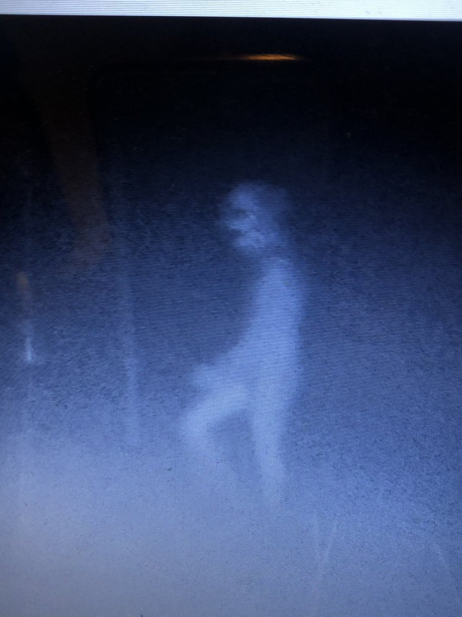 Cwatson760's tweet photo. OMG. My fiancé’s dads friends deer cam.  WTF https://t.co/OPmZwLaI8f
