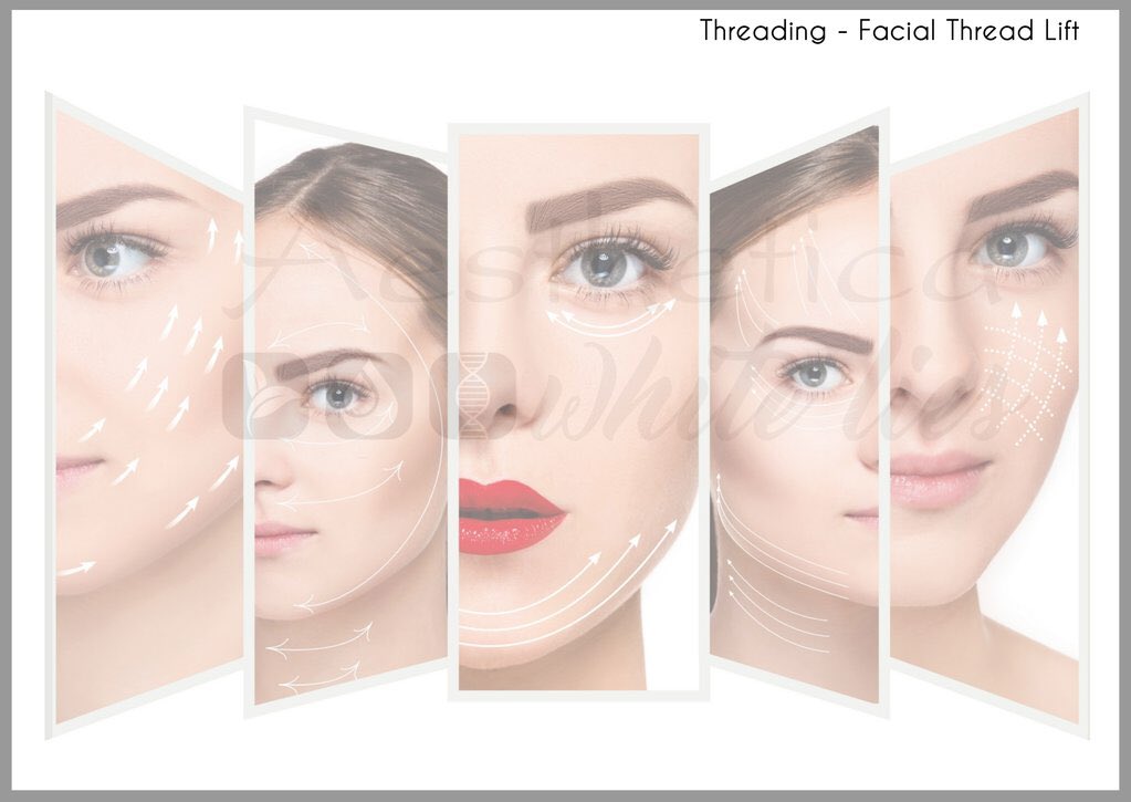 SkinAesthetica's tweet image. Beautiful Skin #skin2go #facialthreading #facialthreads #lovetheskinyourein @aestheticaskincentre @whiteliesaesthetics