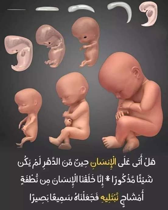 أيها الولد..
             أمك وأبيك حبهما مقدم على محبتك لنفسك وزوجك وولدك والناس أجمعين..
والمحبة ليست كلاما.. بل طاعة وعطاءاً بلاحدود..
أقرأ وتعلم في شأن البر والعقوق..