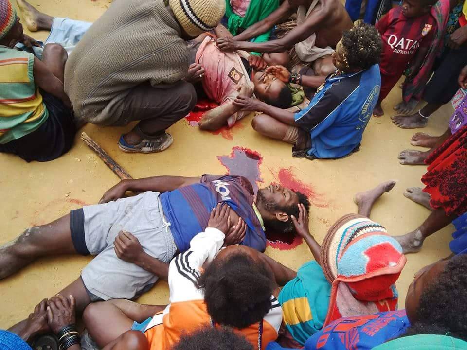FreeWestPapua's tweet photo. FACT: Human rights do not exist in occupied #WestPapua. Over 500,000 civilians have been slaughtered by #Indonesia https://t.co/WiXBt9jnyZ