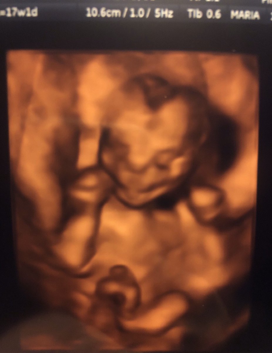 analisevm's tweet photo. Now that the cat’s out of the bag with the family - I figured it was time to make the official announcement to work family as well! 

Baby Girl Charlie Torres coming May 2020. Thank you to all my 🎯 fam who have been so supportive of me on this journey! 

#target #targetbaby https://t.co/iwP8HYk5CJ