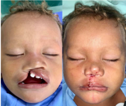 Healing the Children tweet media