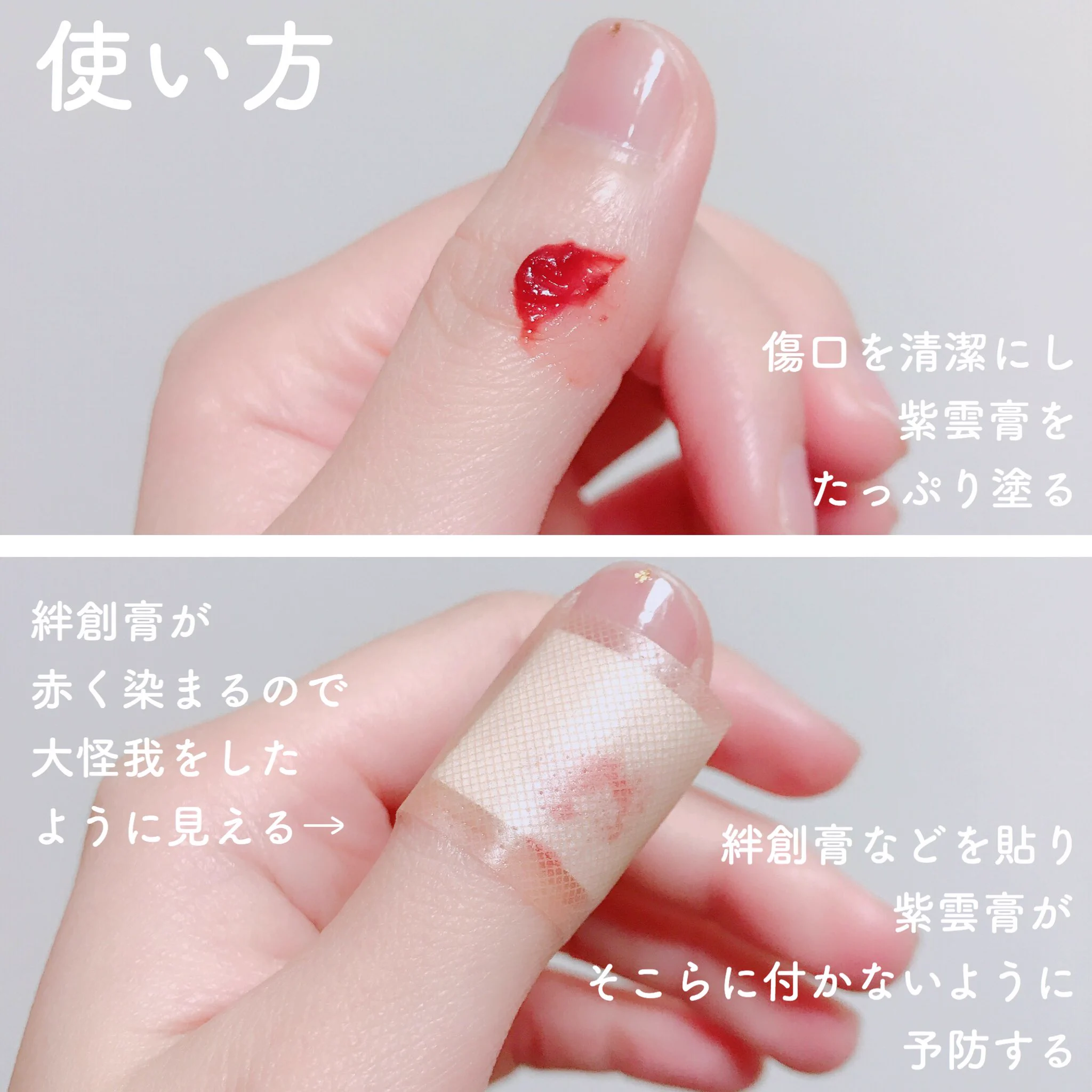 【紫雲膏】外傷・あかぎれ・しもやけによく効く！！冬場は絶対必須アイテム