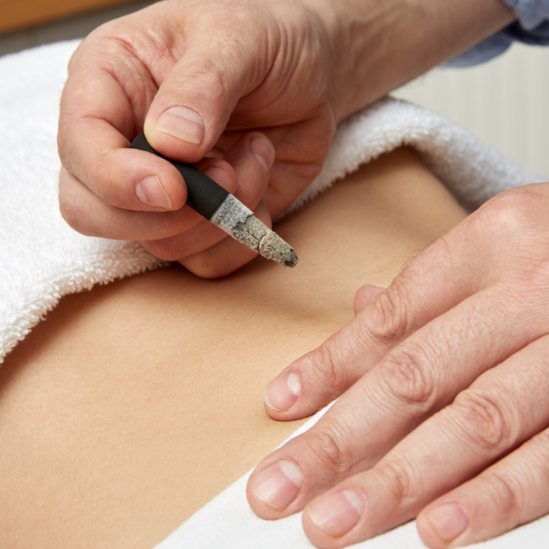 Clknwell_Chiro's tweet image. Book with one of our expert acupuncturists today located in one of our Central London Clinics at Clerkenwell and Islington - all practitioners are members of the British Acupuncture Council
Treatments for muscular problems, fertility support, stress and anxiety, sports injuries