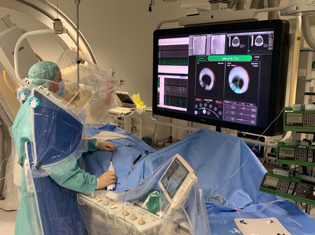 First Laser PVI in our brand new EP-Lab with Zero Gravity Unit. Excellent view on PVs with the latest generation laser X3 system. #klinikumderzukunft #uksh #cardiofocus #heartlight #zerogravity #heartcenterlübeck <a href="/RolandTilz/">Roland Tilz</a> <a href="/CWriedt1/">CoWri</a> <a href="/IngoEitel/">Ingo Eitel</a> <a href="/FraSantoroMD/">Francesco Santoro, MD, PhD</a> <a href="/kyalin4/">kyalin</a>
