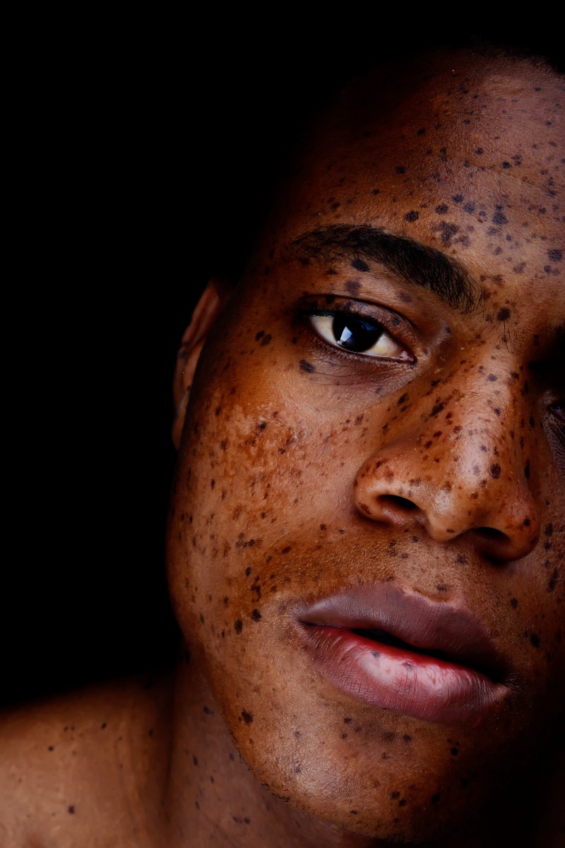 HASSKYLOVE1's tweet photo. Freckles is beautiful
💖💖💖💖💖💖 https://t.co/fdQepgSg69