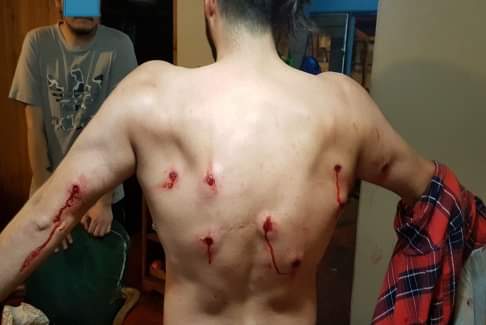 mtel5985's tweet photo. César Hormazábal
Si el pako se está defendiendo, ¿cómo es que el manifestante tiene los balazos en la espalda? https://t.co/M8x8EGoA19