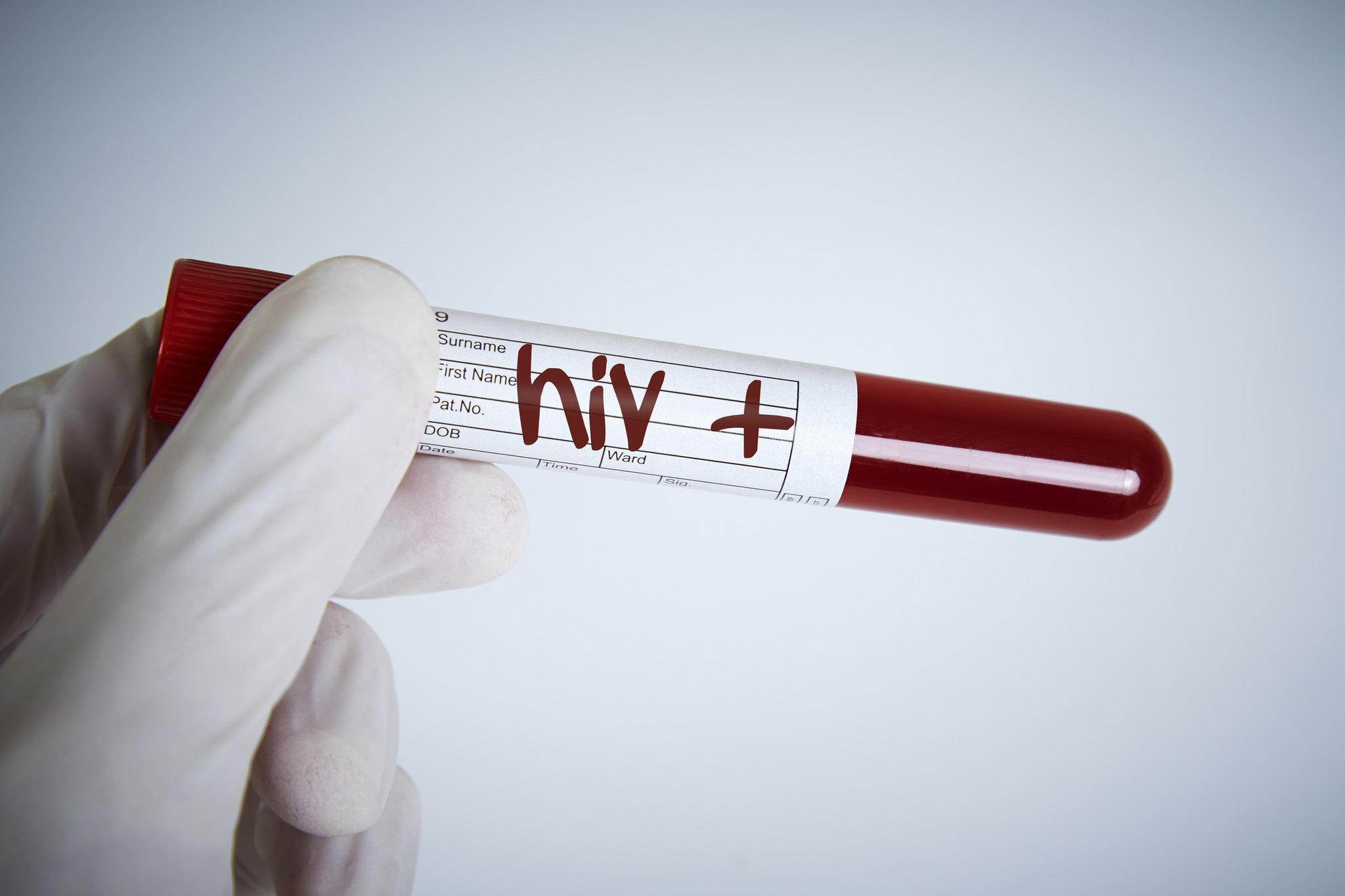 NTV Sağlık on Twitter: "📌 AIDS nedir, HIV testi ne zaman yap