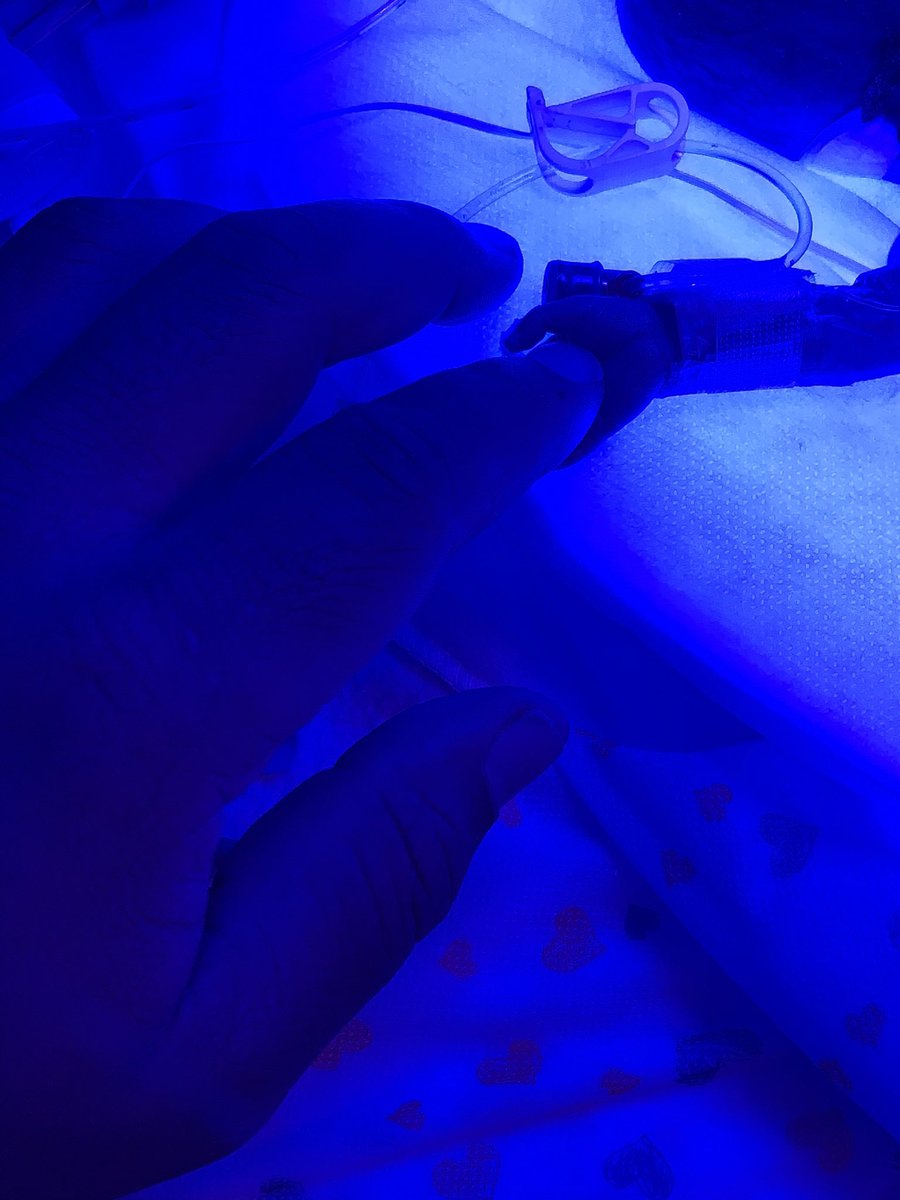 devkamera's tweet image. I heard everything about you except that you would make it here healthy 😢 #Zyon