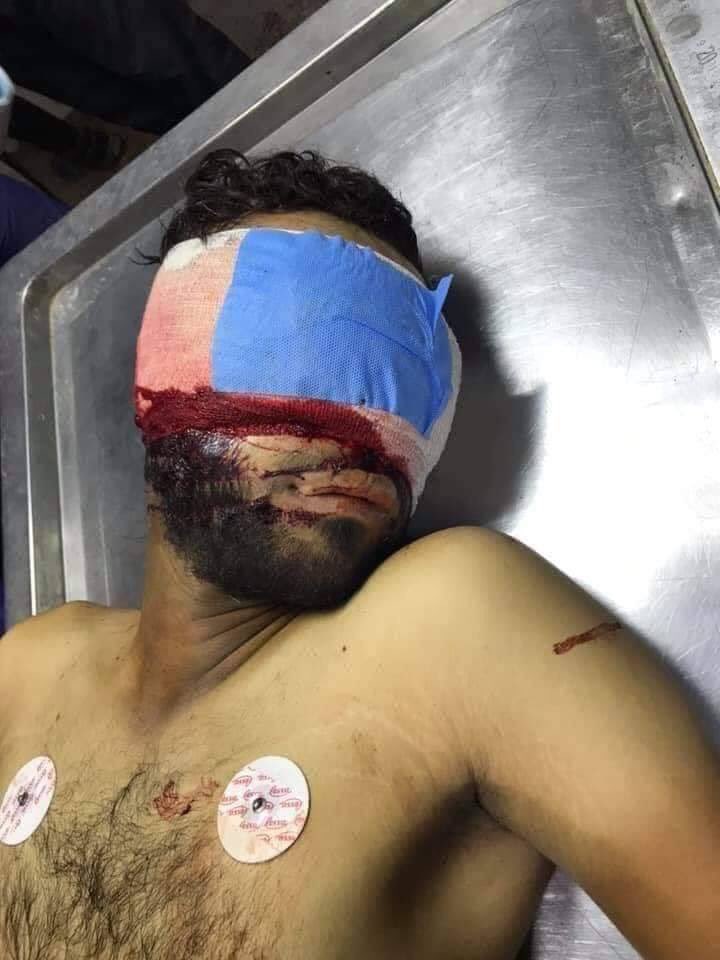 al___h94's tweet photo. محمد من الناصريه

  جاي ينقل مصابين بستوته
وضربته دخانيه لاخلتله لاعيون ولااصابع

وا��تشهد💔ساعه 4الفجر اليوم
للعلم  هوا من طبقه جدا تعبانه ومصدر رزقه هالستوته 
بس اشرف منكم   واغنى منكم بغيرته 
الله يرحمه ويساعدك گلب امه 💔 https://t.co/zmwpjwnGzO