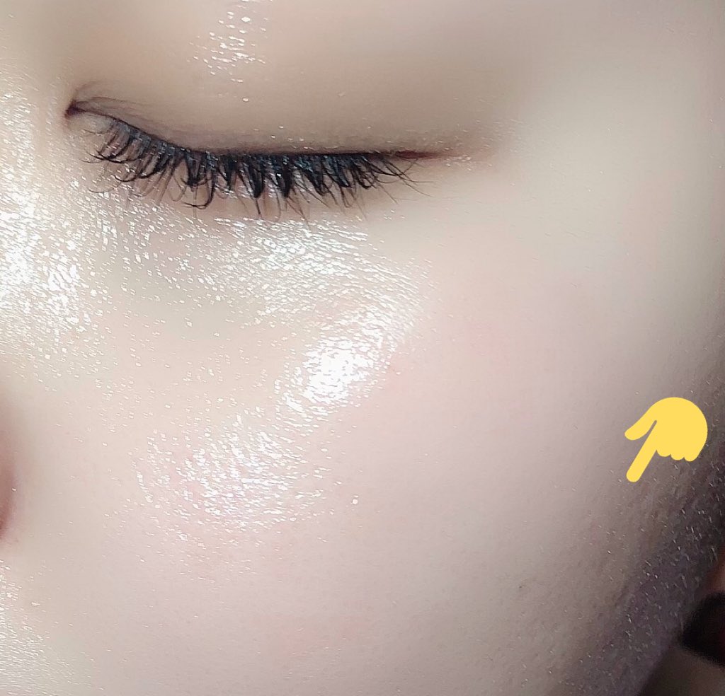 ট ইট র イエベ春 ニキビが大量にあった肌で クレーターは セルフダーマローラーなどで 減ったものの輪郭にはのこってます 赤みがあるニキビ跡はクリアタッチ 初期のものはスムースeクリームをつけて 様子を見ます 保湿はめちゃくちゃして