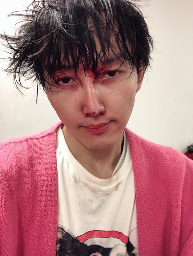 たまごっち Op Twitter 友達 神聖かまってちゃんってライブで流血とかしてるイメージある 怖そう たまごっち そんなことないよ 昔は流血ライブとかあったけど今は全くな たまごっち ごめんやっぱたまにあるわ