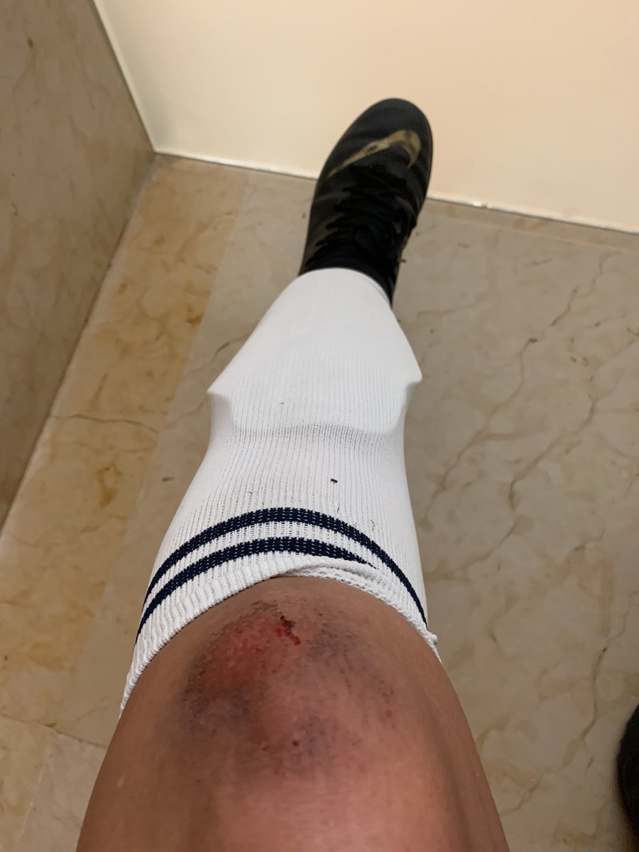 Malapan's tweet photo. Siempre #banda nunca #inbanda #futfemenil #mechinguelarodilla https://t.co/FcpwyfB8TR