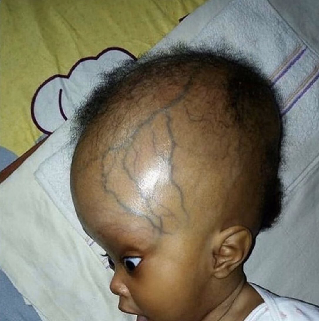 infanciaexterminada tweet media