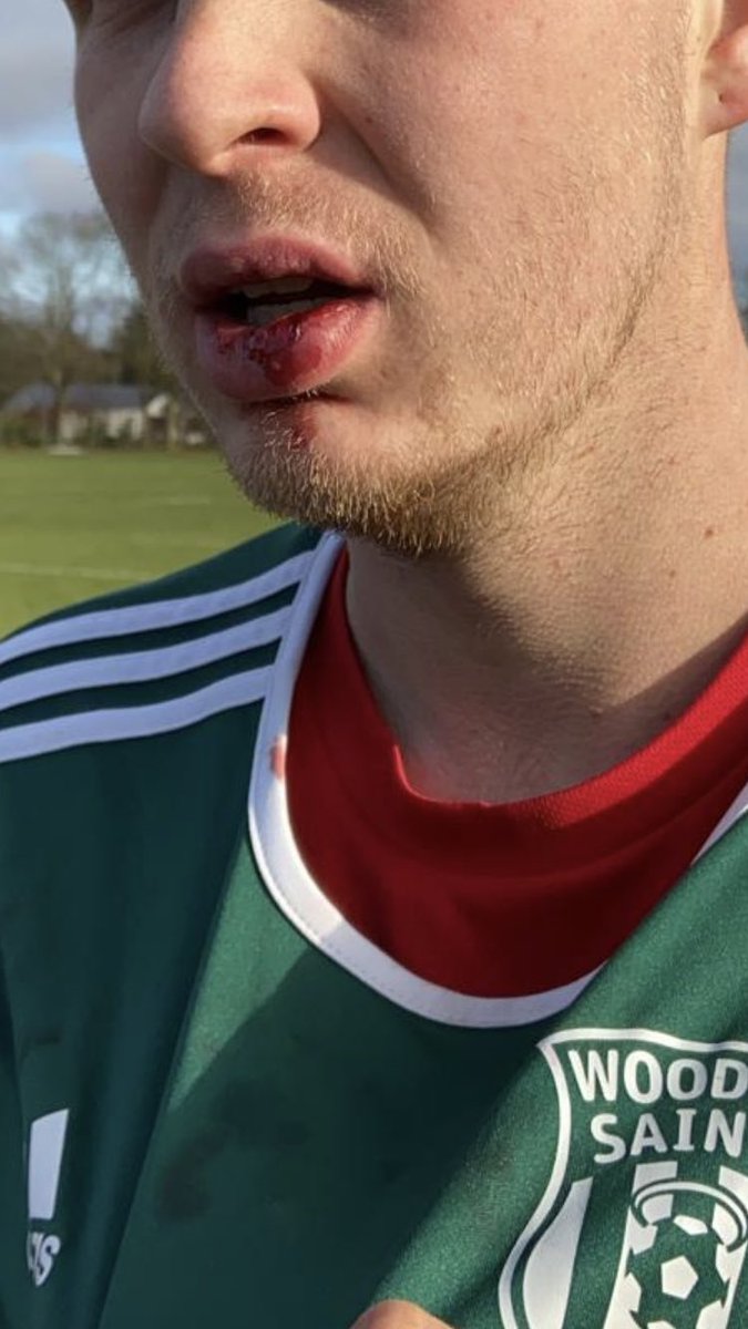 Can hold our heads high after a 3-2 loss to <a href="/FC_Fernhill/">FC Fernhill</a> goals from:

OG ⚽️
<a href="/PaulRake1/">rakey</a> ⚽️

Official was absolutely different class. Looked after the players well and we finished with 10 men 🙄