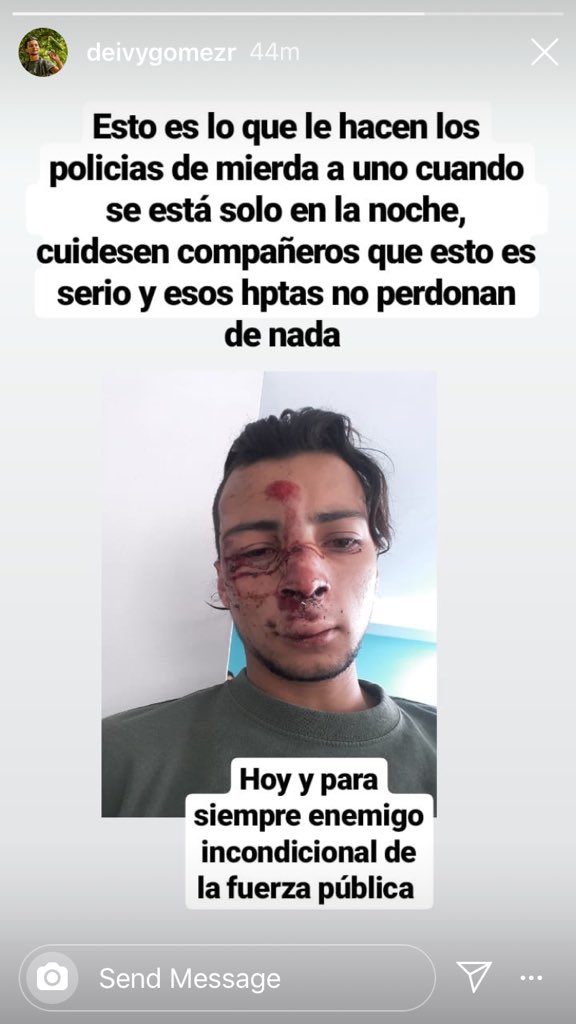 Deivy es estudiante de biología de la U de Caldas. Junto a <a href="/jen_munozz/">JENNY MUNOZ</a>, para su tesis de pregrado, estamos estudiando bandadas mixtas de aves en los Andes. Anoche mientras iba solo en bicicleta para su casa se encontró con la 🤬 policia...

Están fuera de control
#1DParoNacional