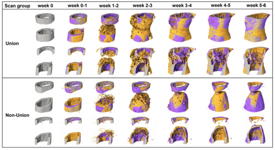 #FractureFriday A longitudinal in vivo micro-CT protocol allows monitoring of healing in mouse femur defect models without significant effects on callus formation and permits tracking of #fracture repair. @nature 
doi.org/10.1038/s41598…
<a href="/isfrfractures/">ORS ISFR</a> <a href="/ORSsociety/">Orthopaedic Research Society</a>  #ORSSML