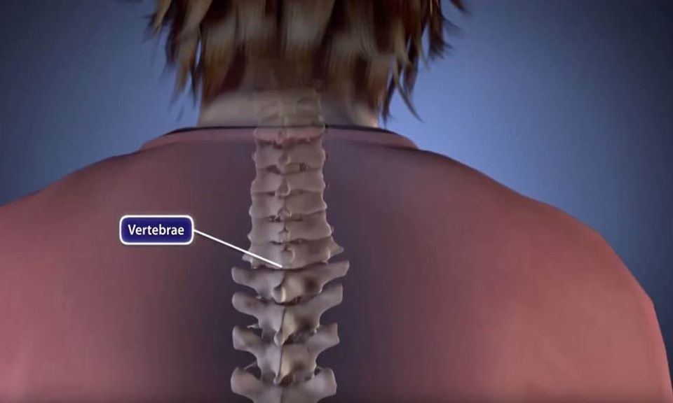 DrSusmitNaskar's tweet photo. 🔸 Will I have pain after #spine #surgery? 🔸
▫️
▫️
▪️ Due to use of modern anesthesia techniques and pain medications most patients have minimal pain following a spine surgery . Follow for more details : https://t.co/u0kooLZaSQ
▫️
▫️
#InvasiveSpineSurgery #SpineSurgery #Sciatica https://t.co/xBQccxG6ps