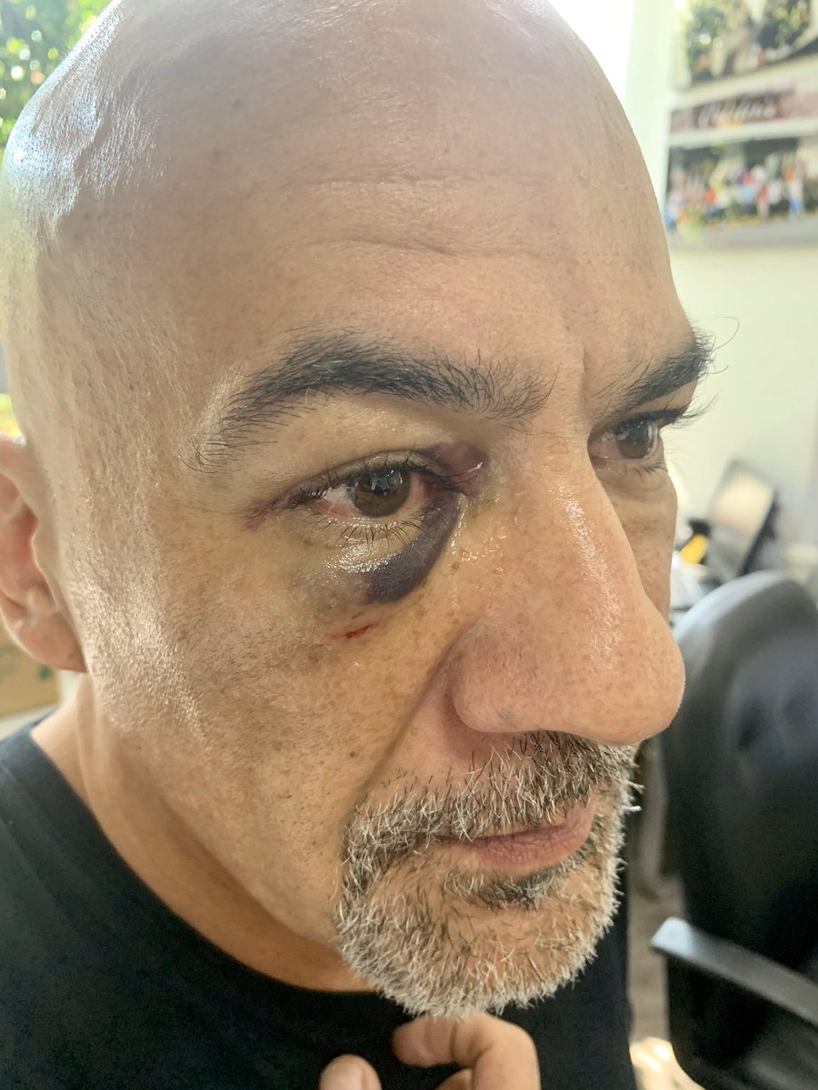 EmmanuelDuprez's tweet photo. Ayer saliendo de los tacos una patrulla se me cerró y dos oficiales me reclamaron que no les cedí el paso. Me seguí de frente dejándolos hablando solos. Me siguieron a la gas y al salir de esta se me cerraron, bajo uno y me golpeó. A denunciar!! https://t.co/9KNroUAXbY